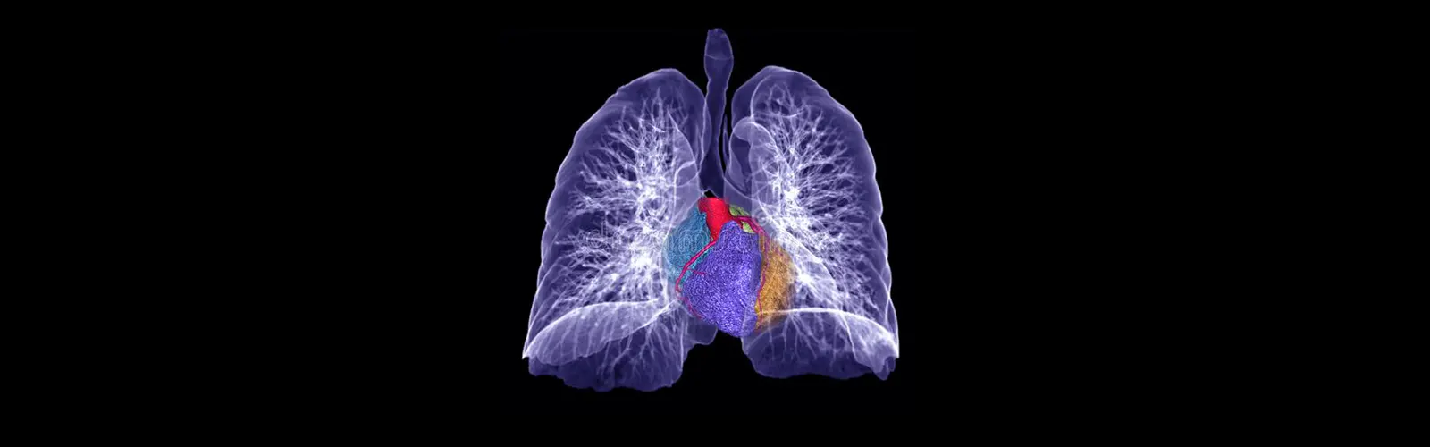 What Is The Cost Of CT Chest 3D?